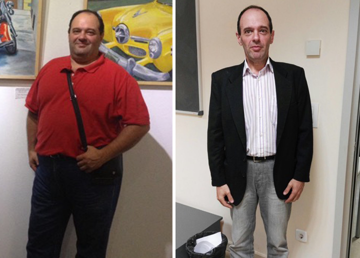 Unidad de Obesidad HMHospitales